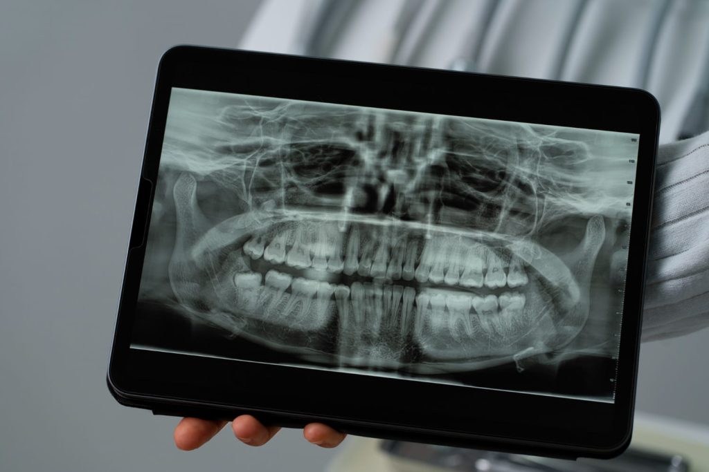 Radiografía 3D dental en Cádiz