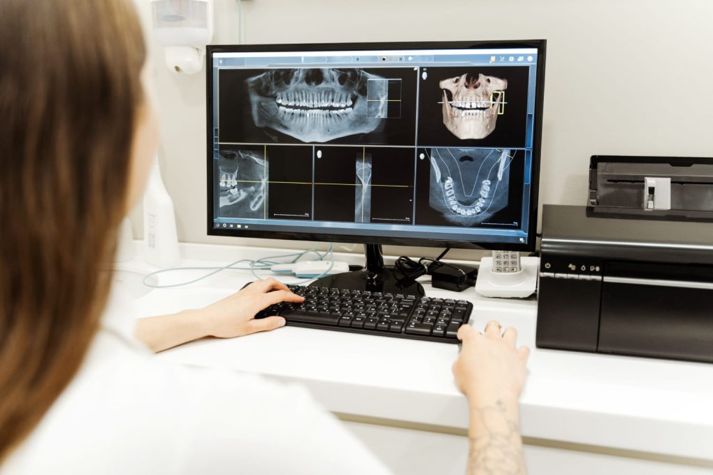 Radiografia en 3d trunser (1)